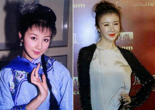 Những ‘thảm họa dao kéo’ của showbiz châu Á - 10