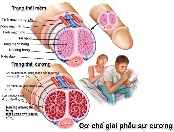 Thanh niên suýt hỏng “của quý” vì gãy dương vật không đi khám - 1