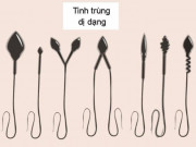 Sức khỏe đời sống - Chất lượng “tinh binh” kém là dấu hiệu nhiều bệnh, quý ông cần lưu ý kẻo &quot;hối không kịp&quot;