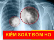 Sức khỏe đời sống - Bi kịch “Bán phổi nuôi dạ dày” và cái kết “đờm, ho, khó thở” hành hạ cả đời