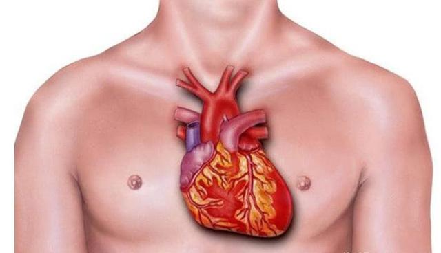 3 đặc điểm nhận biết bệnh nhồi máu cơ tim và 4 kiểu người tốt nhất nên đi kiểm tra - 1