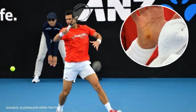 Djokovic dính chấn thương tay trước thềm Australian Open