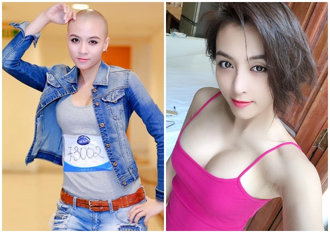 Trước Oanh Yến, trong showbiz Việt cũng có nhiều mỹ nhân cạo trọc đọc. Hoa Di Linh từng gây được chú ý khi tham gia cuộc thi Vietnam Idol 2015 với hình ảnh ảnh đầu trọc. Hình ảnh xinh xắn, khả ái khi đó của người đẹp đến từ Hà Nội nhận được sự chú ý của khán giả và truyền thông. Biệt danh &#34;mỹ nhân đầu trọc&#34; của cô cũng xuất phát từ sự kiện này.
