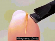 Bạn trẻ - Cuộc sống - Clip: Mẹo sơ cứu hữu ích không phải ai cũng biết