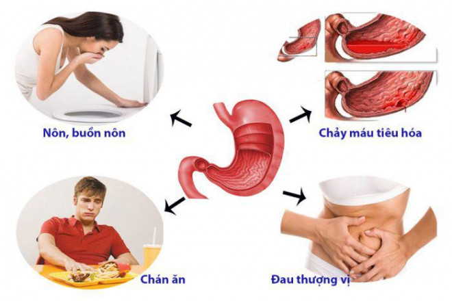 5 nguyên tắc ăn uống cho người bị viêm dạ dày, nên &#34;tuân thủ&#34; để làm dịu cơn đau hiệu quả - hình ảnh 1