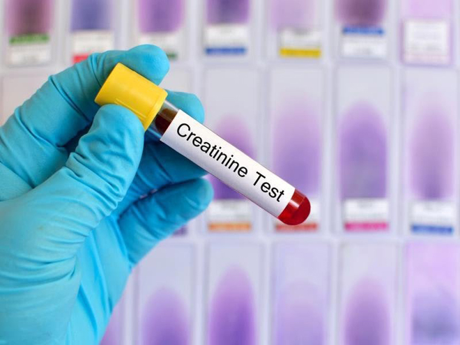 Chỉ số creatinin giúp đánh giá chính xác chức năng thận