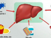 Sức khỏe đời sống - Bí quyết giải độc gan trước kỳ nghỉ lễ