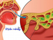 Sức khỏe đời sống - 8 biện pháp làm giảm ngạt mũi cho F0