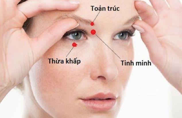 Vị trí các huyệt toản trúc, thừa khấp, tình minh.