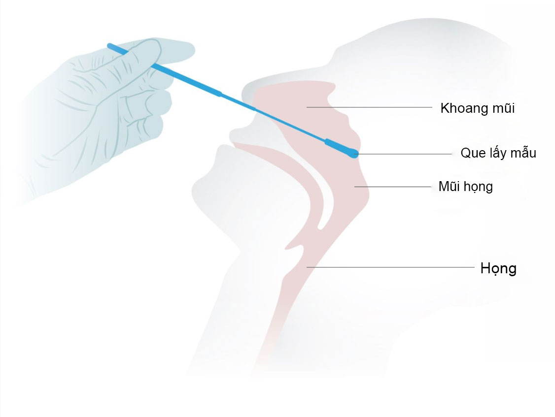 5 lưu ý khi sử dụng kit test nhanh COVID-19 tại nhà để có kết quả chính xác nhất - 3