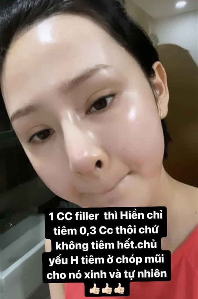 Cô từng lên tiếng về việc tiêm filler mũi khi được người hâm mộ hỏi.
