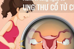 Những hành vi làm tăng nguy cơ ung thư cổ tử cung