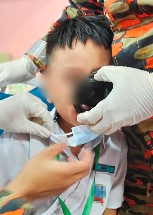 Cậu bé 7 tuổi ở Malaysia bị mắc kẹt môi trong miệng bình nước, được “giải cứu” thế nào? - hình ảnh 2