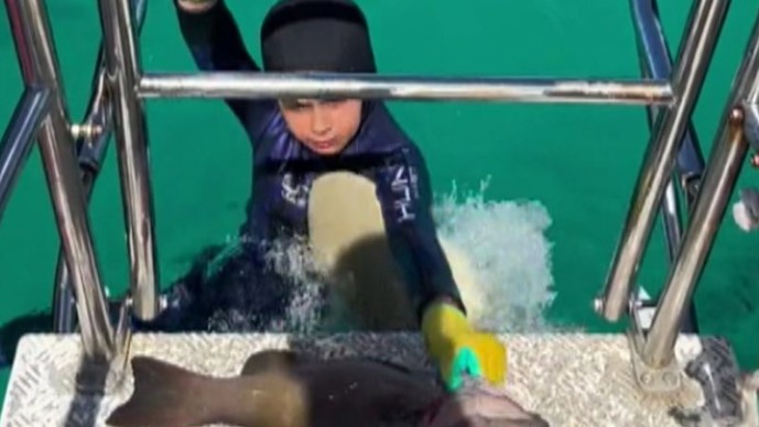 Cậu bé 8 tuổi bị con cá mập cắn vào phần ngực. Ảnh: Today