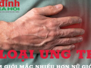 Sức khỏe đời sống - 4 loại ung thư nam giới mắc nhiều hơn nữ giới