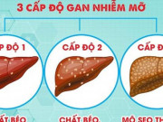 Sức khỏe đời sống - 4 món ăn bài thuốc phòng trị gan nhiễm mỡ