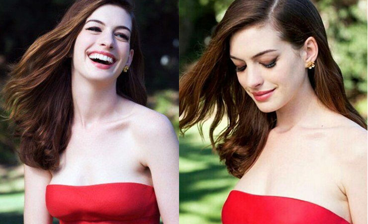 Bên cạnh&nbsp;ý kiến khẳng định rằng Anne Hathaway&nbsp;đã can thiệp y tế cũng có người thanh minh cho cô.&nbsp;
