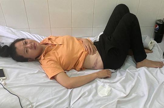 Nữ công nhân ở Đồng Nai bị giám đốc người nước ngoài đánh nhập viện - 2