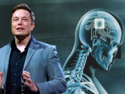 Thế giới - Elon Musk muốn cấy chip vào não người, vì sao Mỹ liên tục từ chối?