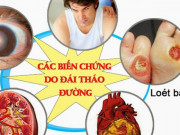 Sức khỏe đời sống - Bị cắt cụt 2 bàn chân do bệnh tiểu đường, chuyên gia cảnh báo người bệnh tuyệt đối không chủ quan với 5 biến chứng này!