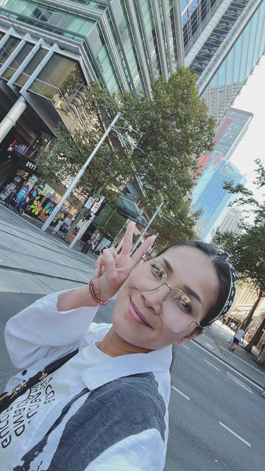 Ca sĩ Hồng Ngọc sau tai nạn bị bỏng nặng khuôn mặt - 2