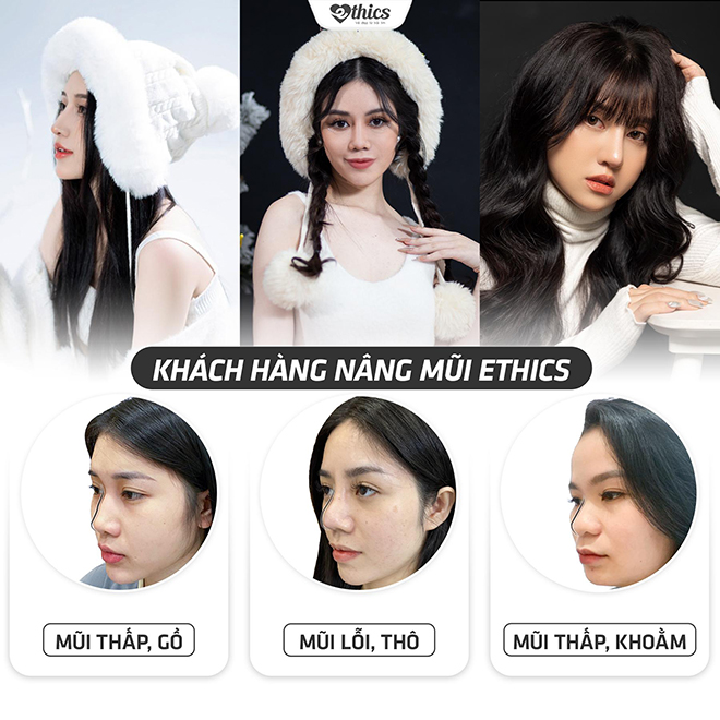 Thẩm mỹ viện Ethics - 8 năm miệt mài làm đẹp bằng cả trái tim cho phụ nữ Việt - 7