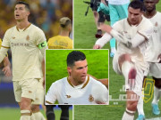 Bóng đá - Ronaldo lên tiếng, bị fan Al Nassr mắng thậm tệ đòi đuổi cổ