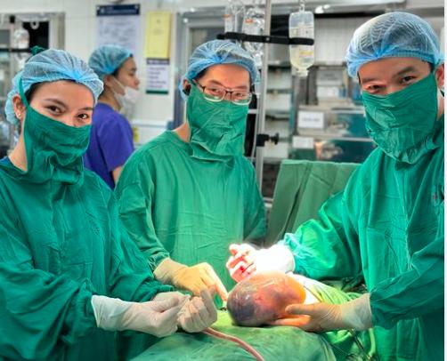 Hy hữu ca sinh đôi ở Hà Nội, một bé còn nguyên trong bọc ối - 1