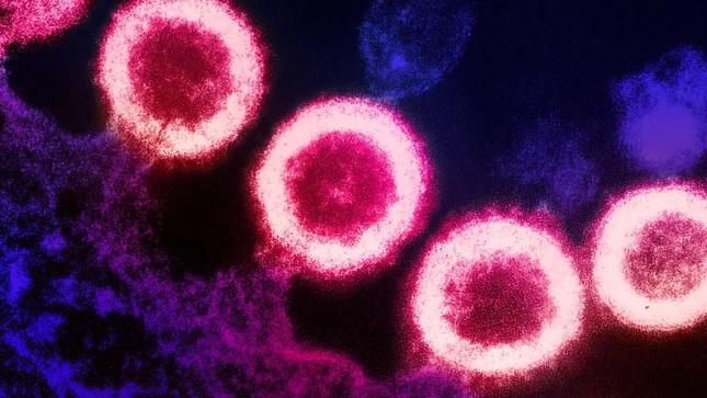 Hình ảnh dưới kính hiển vi này cho thấy các hạt virus HIV-1 (màu hồng) đang nhân lên từ màng tế bào miễn dịch bị nhiễm bệnh (màu tím).