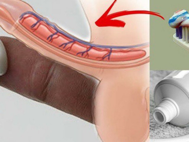 Bôi kem đánh răng chống xuất tinh sớm có hiệu quả không?