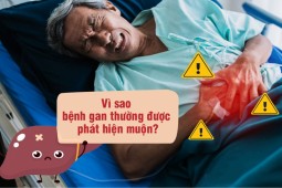 Cảnh báo: Nhiều người phát hiện bệnh gan khi đã ở giai đoạn nặng