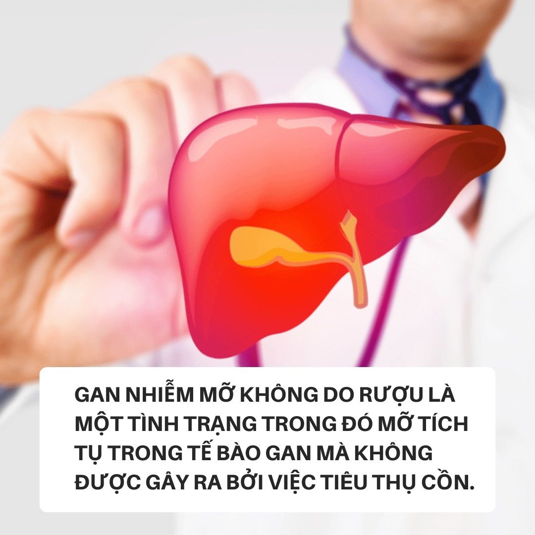 Khắc tinh của gan nhiễm mỡ là loại quả mọi người thường kho cá, nấu canh - 2