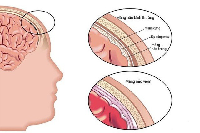 Cấu trúc màng não của cơ thể. Ảnh minh họa