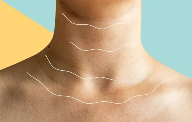 Nguyên nhân khiến da cổ xuống cấp và cách khắc phục - 1