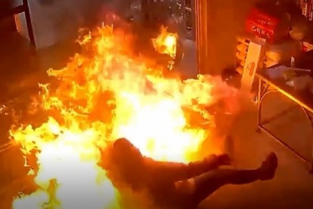 Cố dập đám cháy trong bếp, người phụ nữ suýt hóa ngọn "đuốc sống"