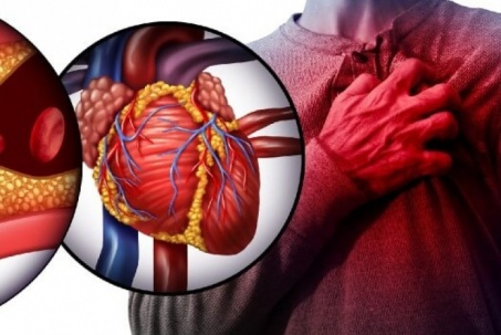 3 điều tuyệt đối không làm khi lên cơn đau tim