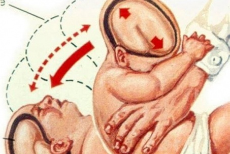 Bé 2 tháng tuổi bị tổn thương thần kinh vì hành vi người lớn thường làm mà không hay biết