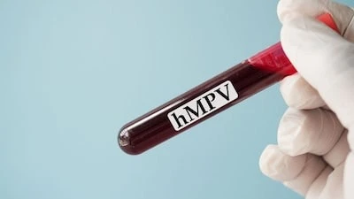 Biết gì về HMPV: Virus đang lây ở Trung Quốc?