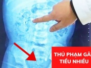 Ai cũng nghĩ đi tiểu ngày hơn 8 lần, đêm 3- 4 lần là bình thường, cho đến khi chuyên gia vạch trần thủ phạm mới vỡ lẽ