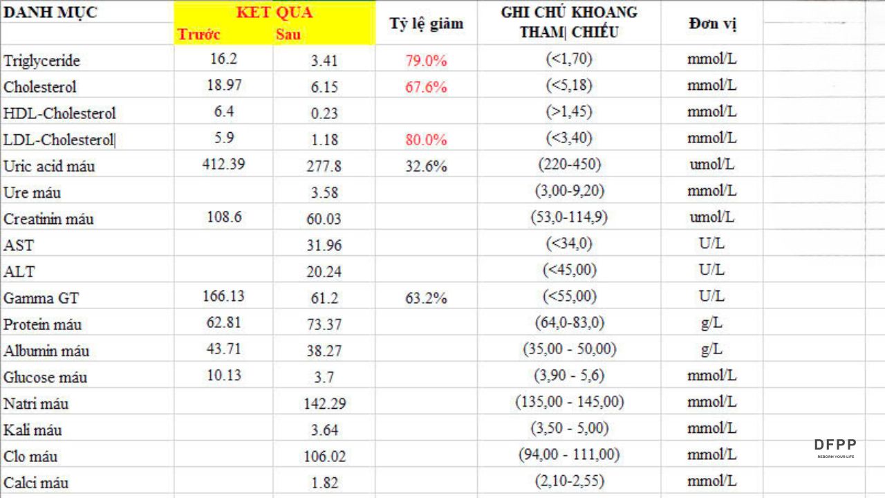 Bảng so sánh kết quả trước, sau khi thực hiện phương pháp lọc máu DFPP của một bệnh nhân gặp tình trạng mỡ máu cao và men gan cao
