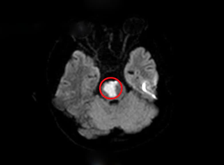 Kết quả chụp MRI.