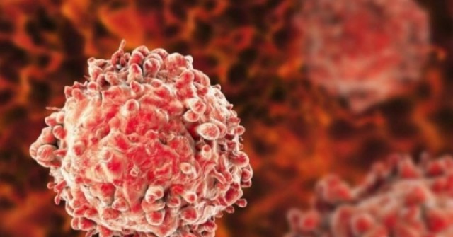 10 dấu hiệu cảnh báo sớm nguy cơ mắc bệnh ung thư