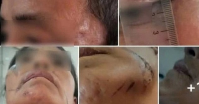 Bị đánh đập, treo lên cây do bị nghi làm bùa ngải khiến người khác tử vong