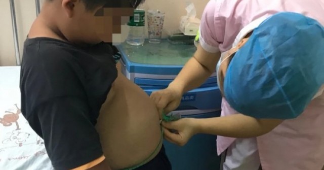 Bé 10 tuổi đã bị gan nhiễm mỡ thừa nhận thường xuyên ăn 3 món khoái khẩu này