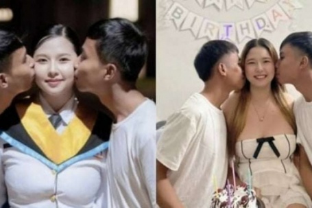 Cặp song sinh yêu chung một cô gái khiến dư luận tranh cãi