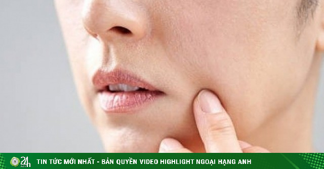 Lý do thiếu hụt protein khiến da nhanh chảy xệ