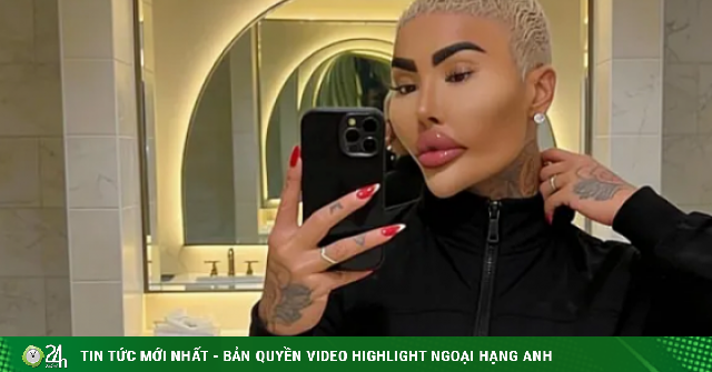 'Vua môi' qua đời