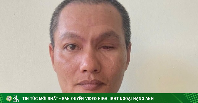 Kẻ đòi giật súng của công an ra đầu thú