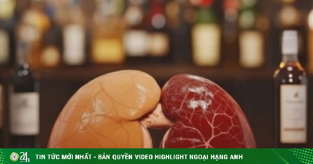 5 loại nước là “vua hại thận”, nhiều người uống mỗi ngày mà không biết