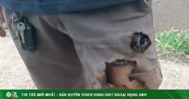 Điện thoại phát nổ cứu sống một người khỏi nanh vuốt chó dữ